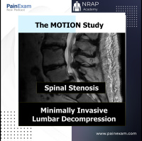 The MOTION Study: Minimally Invasive Lumbar Decompression