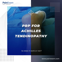 PRP for Achilles Tendinopathy