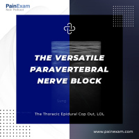 The Versatile Paravertebral Nerve Block