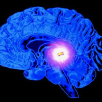 Getting a Good Nights Sleep