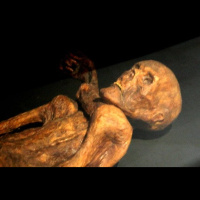 Iceman Ötzi Died with a Bellyache
