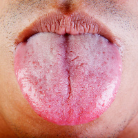 Mouth Sets Healing Standard