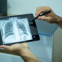 Delivering Equitable Lung Cancer Care [Sponsored]