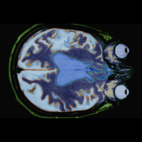 Traces of Genetic Trauma Can Be Tweaked