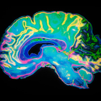 Pregnancy Primes the Brain for Motherhood