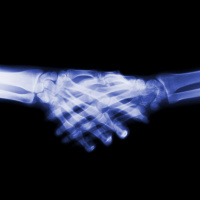 Bone Building Needs Bit of Breakdown First