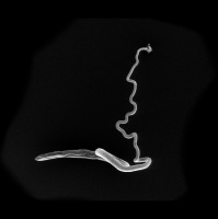 Gut Parasites Have Their Own Gut Microbiomes