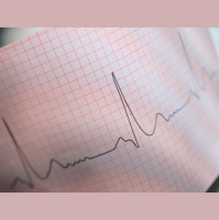 Radiation Might Help Heart Regain Its Rhythm