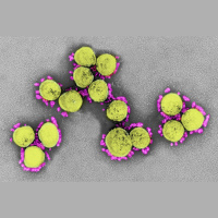 Neandertal DNA May Be COVID Risk