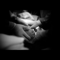 Ep. 48 Gentle Cesarean 