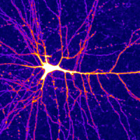 Hidden Computational Power Found in the Arms of Neurons