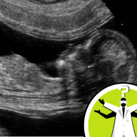 How do cells know what they will be when they grow up?