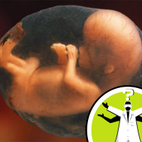 Why dont umbilical cords become tangled?