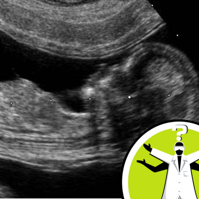 Question Of The Week - From The Naked Scientists