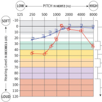 USPSTF Recommendation: Screening for Hearing Loss in Older Adults