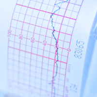 USPSTF Recommendation: Screening for Atrial Fibrillation With Electrocardiography
