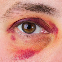 USPSTF Recommendation: Screening for Intimate Partner Violence