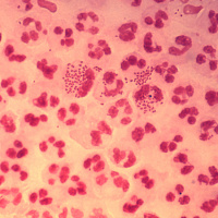 USPSTF Recommendation: Behavioral Counseling Interventions to Prevent Sexually Transmitted Infections