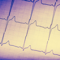 USPSTF Recommendation: Screening for Cardiovascular Disease Risk With Electrocardiography