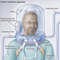 Noninvasive Ventilation of COVID-19 Patients
