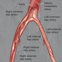 USPSTF Recommendation: Nontraditional Risk Factors and Peripheral Artery Disease