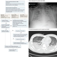 Coronavirus in New York - Report From the Front Lines