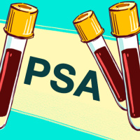 USPSTF Recommendation: Screening for Prostate Cancer