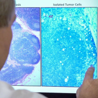 Deep Learning Algorithms for Detection of Lymph Node Metastases From Breast Cancer