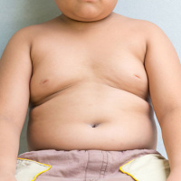 USPSTF Recommendation: Screening for Obesity in Children and Adolescents