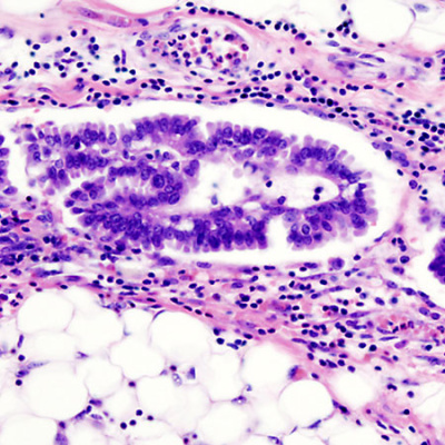 Jama Author Interviews: Covering Research In Medicine, Science,  Clinical Practice. For Physicians, Researchers,  Clinician