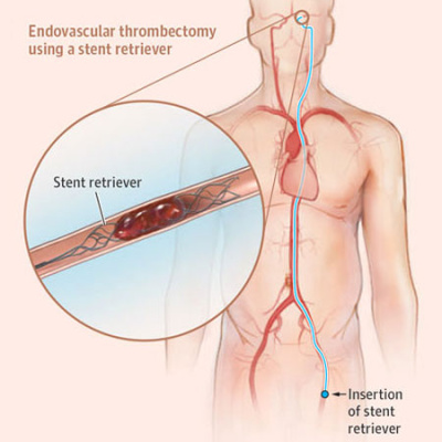Jama Author Interviews: Covering Research In Medicine, Science,  Clinical Practice. For Physicians, Researchers,  Clinician