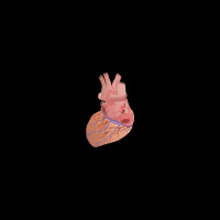 265. Truncus Arteriosus