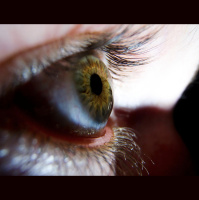 399. Corneal Transplant