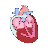 431. Cardiac Tamponade