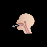 270. The Difficult Airway