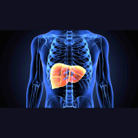 375. Approach to Liver Masses