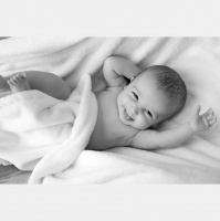 340. Congenital Diaphragmatic Hernias