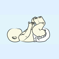 238. Umbilical Hernias