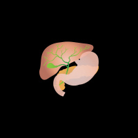 247. Laparoscopic Cholecystectomy