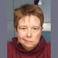 407. Facial Nerve Palsy Part 2