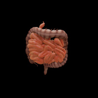 310. Short Bowel Syndrome 