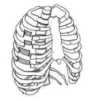 430. Rib Fractures
