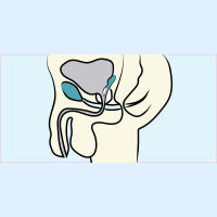 67. Urology 101: Prostate Cancer
