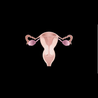 282. Ovarian Cancer