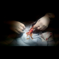 326. Assessment and Management of Extensor Tendon Injuries