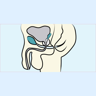 Surgery 101