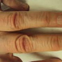 Episode 228 - Knuckle-Crease Daubert Hearing