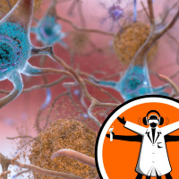 How Alzheimers Disease Unfolds