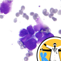 Targeting cancer genes