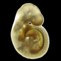 The Case of the Missing Folate